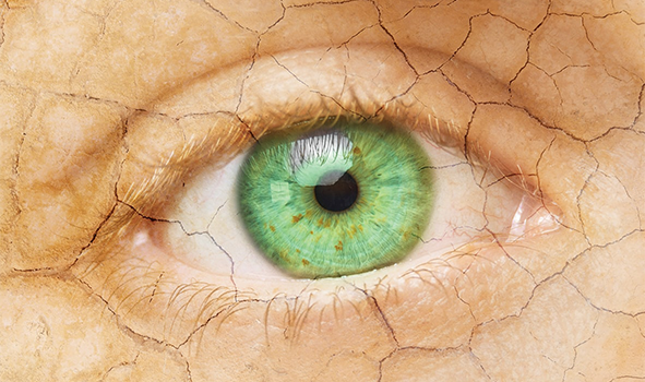 Lentes esclerais para olho seco lentes-esclerais