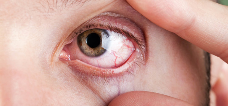 Exercícios para os olhos funcionam? exercícios para os olhos funcionam?